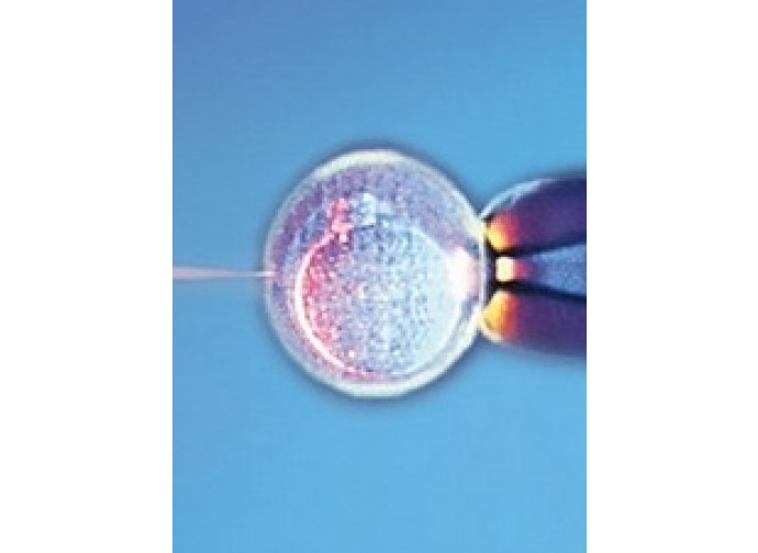 Fecondazione in vitro Fecondazione in vitro
